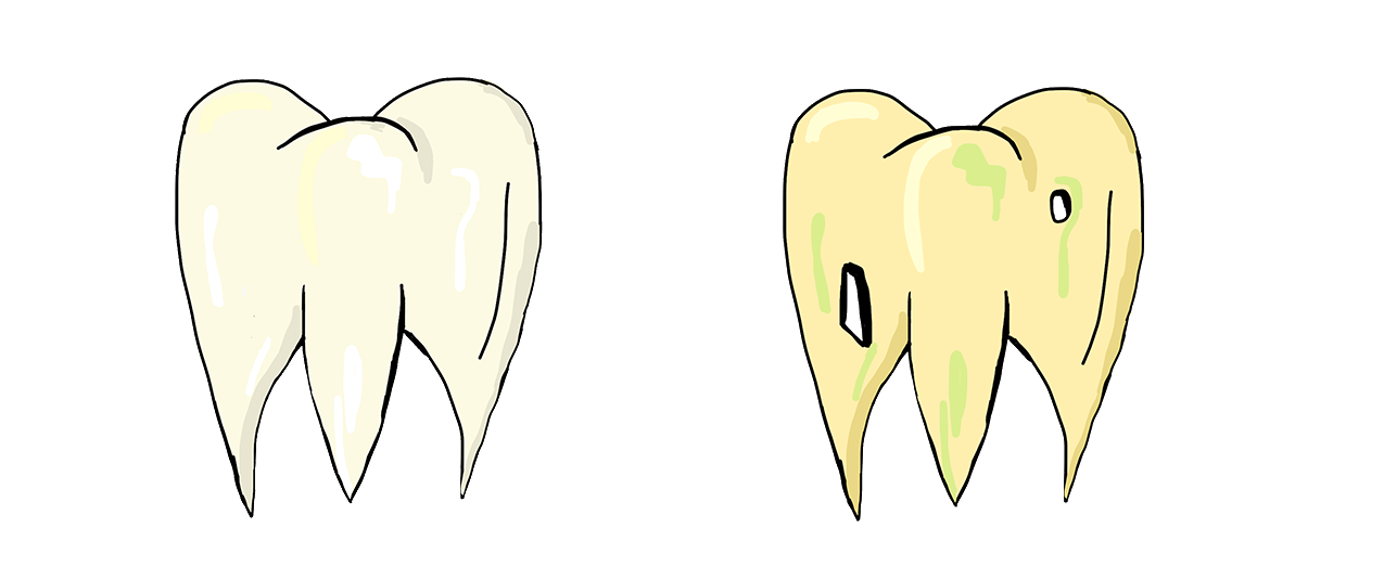 Sour Tooth tooth art